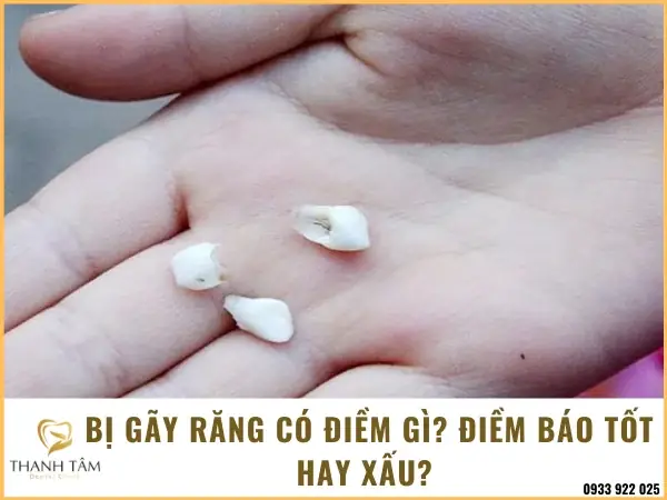 Giải Mã Giấc Mơ Rụng Răng: Điềm Báo Tốt Hay Xấu Và Những Con Số May Mắn