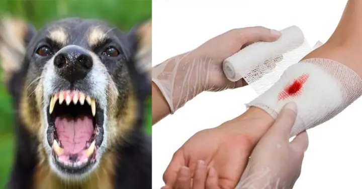 Mơ Thấy Chó Cắn Chảy Máu.
