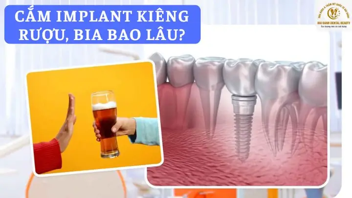 Giải Mã Giấc Mơ Bị Côn Trùng Cắn Chảy Máu: Ý Nghĩa Tâm Lý Và Điềm Báo