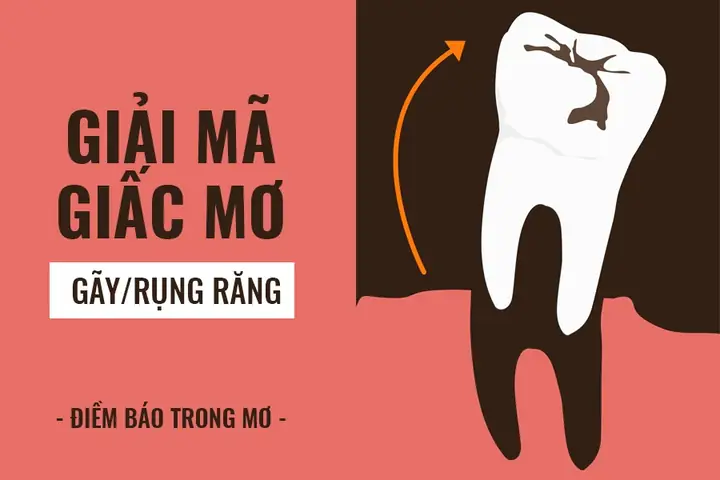 Giai Ma Giac Mo Bi Gay Rung Rang La Tot Lanh Hay Xui Xeo Giai Ma Giac Mo Bi Gay Rung Rang La Tot Lanh Hay Xui Xeo