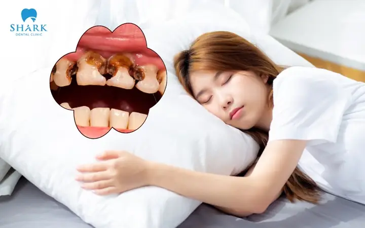 Tổng Quan Về Giấc Mơ Răng Sâu Theo Góc Nhìn Khoa Học
