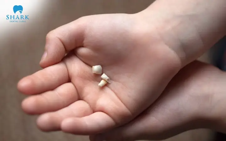Nằm Mơ Thấy Răng Sâu Bị Gãy
