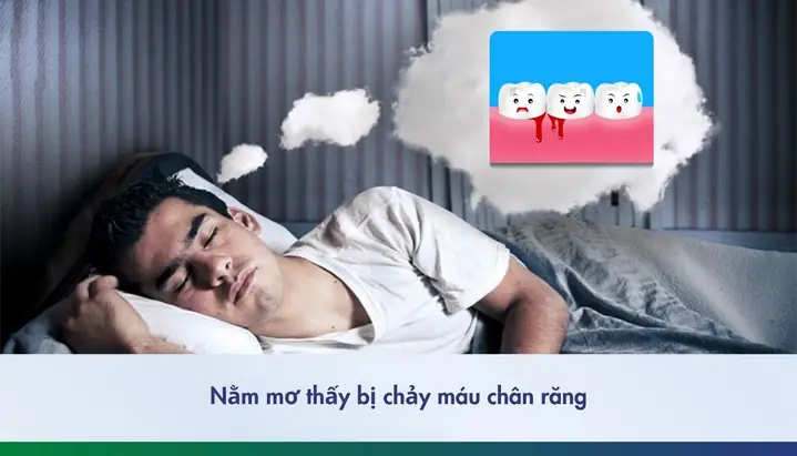 Nằm Mơ Chảy Máu Chân Răng Là Điềm Gì? Giải Mã Giấc Mơ