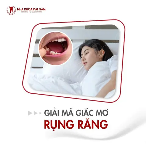 Nằm Mơ Bị Rụng Răng Là Điềm Lành Hay Gỡ? Nằm Mơ Bị Rụng Răng Là Điềm Lành Hay Gỡ?