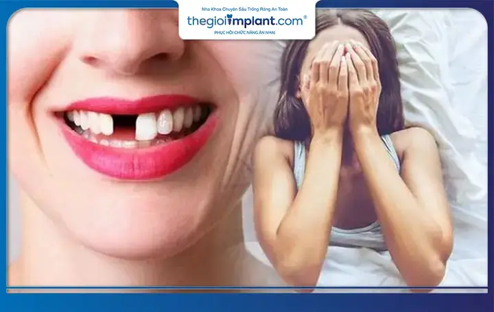 Chăm Sóc Sức Khỏe Răng Miệng