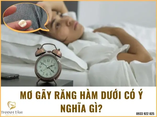 Giải Mã Giấc Mơ Rụng Răng Hàm: Dấu Hiệu Tâm Lý Hay Điềm Báo Tương Lai?