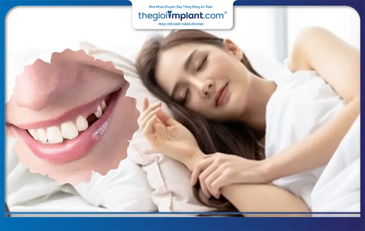Tại Sao Bạn Mơ Thấy Bị Rụng Răng