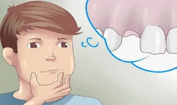 Giải Mã Giấc Mơ Thấy Rụng Răng Hàm Dưới Không Chảy Máu
