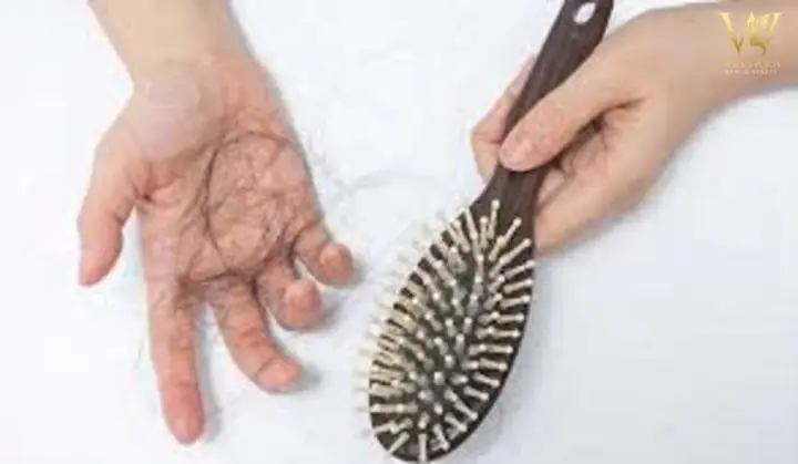 Tóc Rụng Nhiều Thiếu Chất Gì?