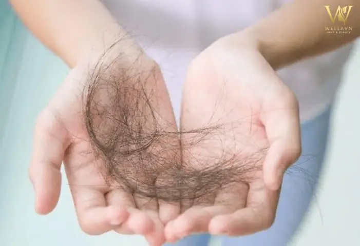 Mơ Thấy Rụng Tóc: Điềm Lành Hay Dữ? Mơ Thấy Rụng Tóc: Điềm Lành Hay Dữ?