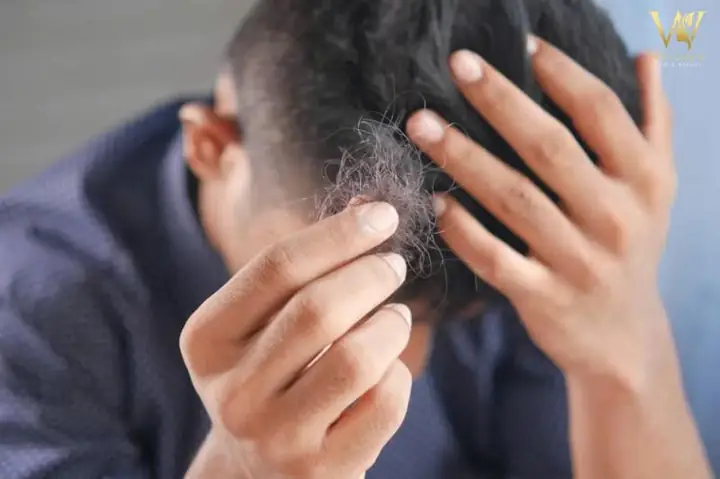 Đàn Ông Mơ Thấy Tóc Rụng Đàn Ông Mơ Thấy Tóc Rụng