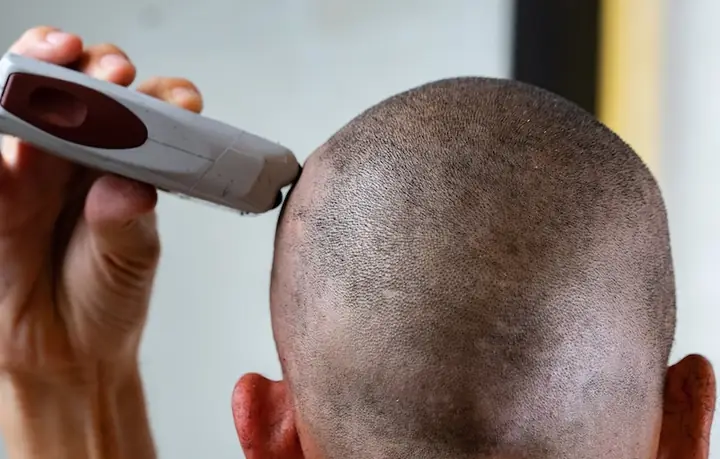 Mơ Cạo Trọc Đầu