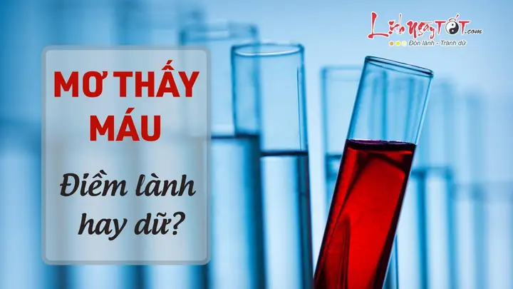 Mo Thay Mau Diem Gi, Lanh Hay Du?