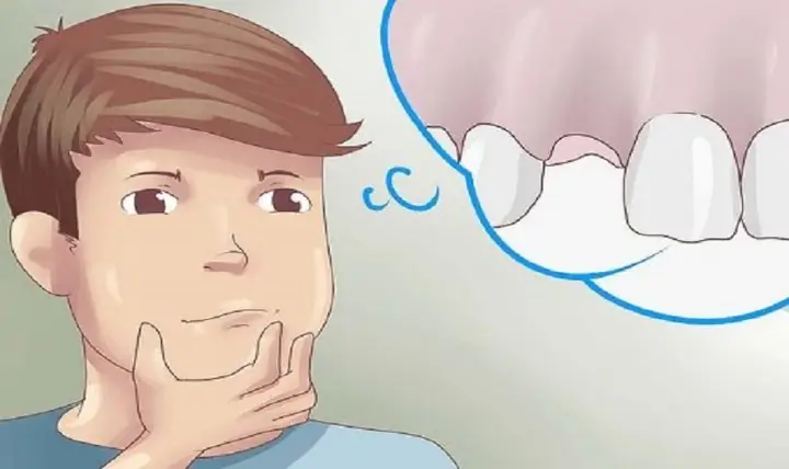 Giải Mã Giấc Mơ Thấy Mình Bị Rụng Răng: Ý Nghĩa Tâm Lý Và Điềm Báo Trong Đời Sống