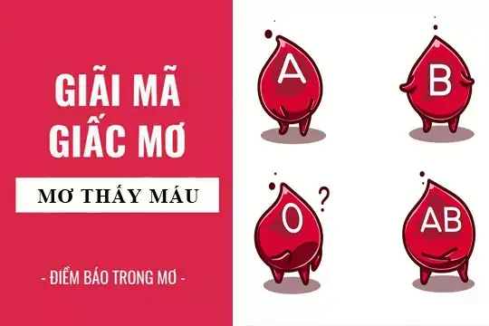 Mæ¡ Tháº¥y Mã¡u Lã Äiá»m Lã Nh Hay Dá»¯, Cáº§n Lã M Gã¬ Äá» Trã¡nh Rá»§i Ro?-2