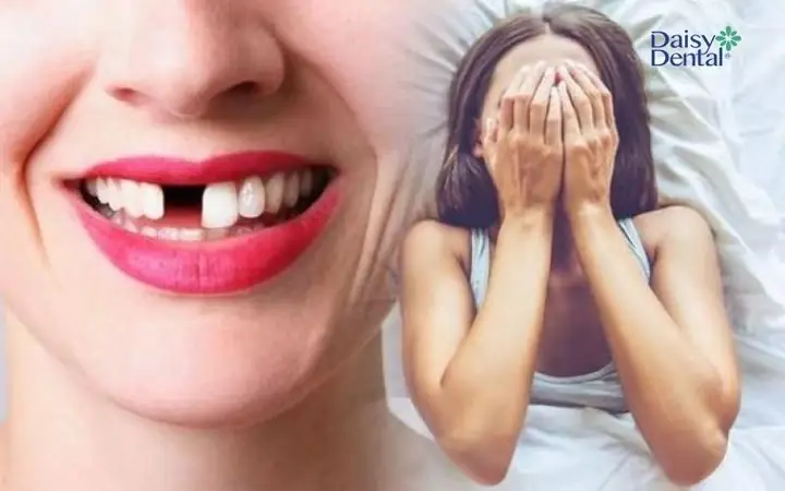 Nằm Mơ Thấy Rụng Răng Giả