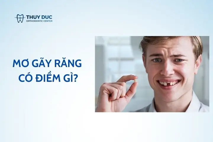 Mơ Gãy Răng Có Điềm Gì?- Nhìn Từ Góc Độ Khoa Học & Tâm Linh - Bác ...