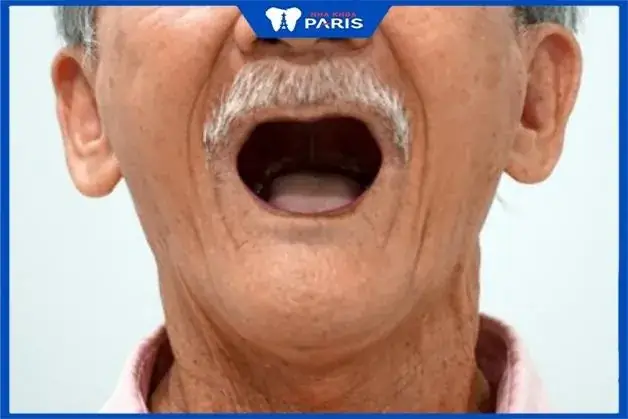 Ngủ Mơ Thấy Rụng Hết Răng