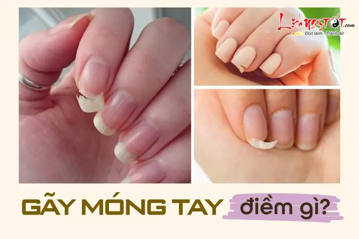 Gãy Móng Tay Là Điềm Gì? Liệu Có Hiểm Nguy Nào Đang Rình Rập ...