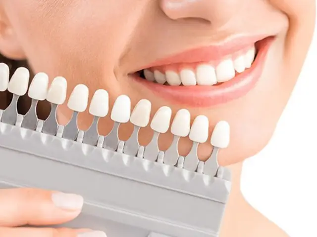 Nằm Mơ Thấy Làm Răng Mới Thể Hiện Điểm Báo Lành Hay Dữ?