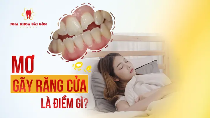 Mơ Gãy Răng Cửa - Giấc Mơ Kỳ Lạ Và Ý Nghĩa Tâm Linh | Nha Khoa ...