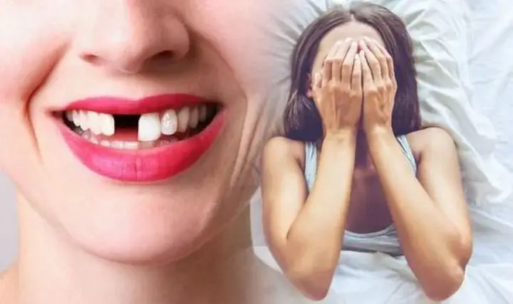 Nằm Mơ Thấy Gãy Răng Là Điềm Báo Gì? Giải Mã Ý Nghĩa Chi Tiết