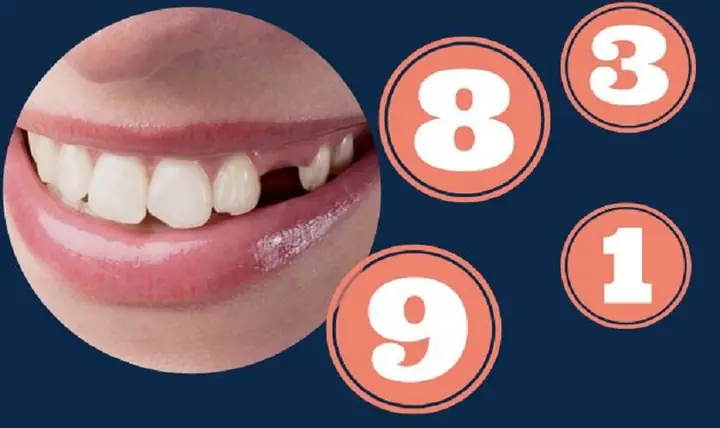 Đánh Con Gì Khi Chiêm Bao Thấy Tự Nhổ Răng?