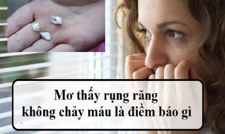 Mơ Thấy Rụng Răng Không Chảy Máu? Là Điềm Báo Tốt Hay Xấu?