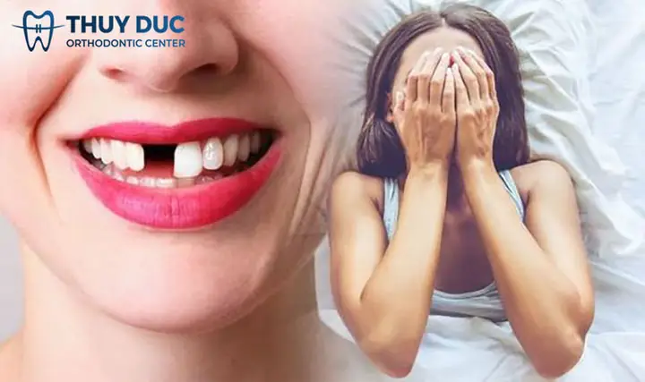 Nằm Mơ Thấy Rụng Răng Rồi Mọc Lại Ám Chỉ Điều Gì?