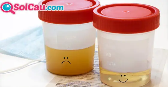 Nằm Mơ Thấy Nước Tiểu Chó