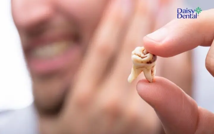 Nằm Mơ Thấy Rụng Răng Cấm Không Chảy Máu