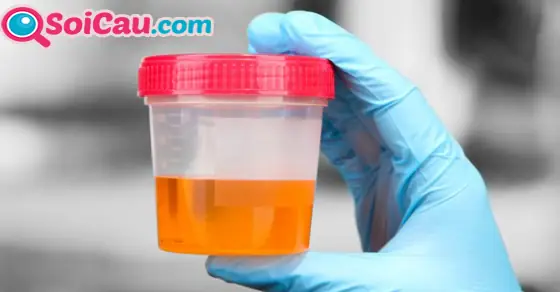 Một Số Giấc Mơ Thấy Nước Tiểu Khác