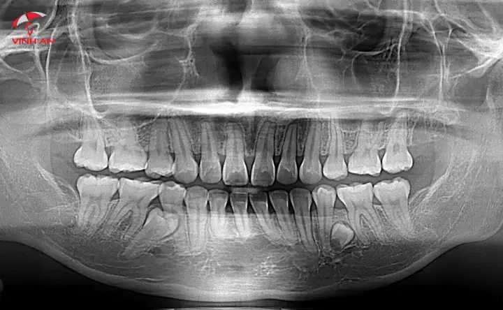 Các Điềm Báo Tiêu Cực Cần Lưu Ý