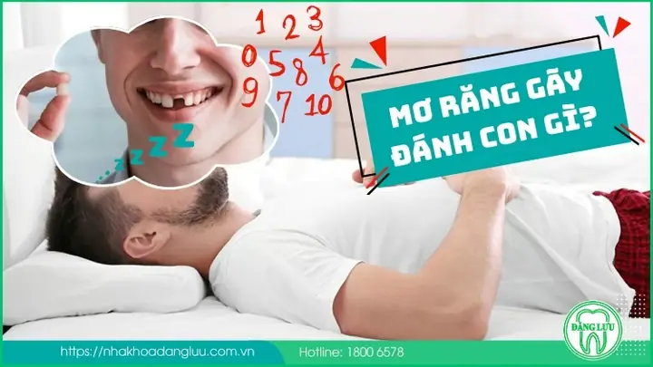 Mơ Răng Gãy Đánh Con Gì? Điềm Báo Ra Sao?