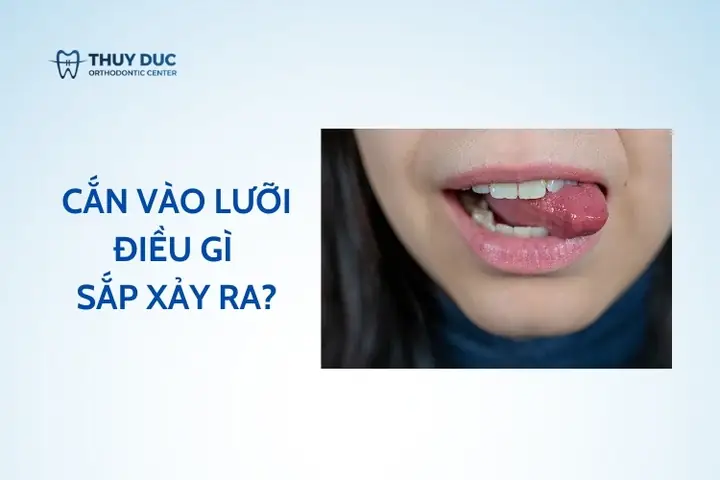 Vô Tình Cắn Vào Lưỡi - Điềm Báo Gì Theo Tâm Linh? - Nha Khoa Thúy ... Vô Tình Cắn Vào Lưỡi - Điềm Báo Gì Theo Tâm Linh? - Nha Khoa Thúy ...