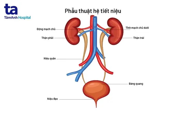 Đi Tiểu Ra Máu (đái Ra Máu) Là Gì? Đi Tiểu Ra Máu (đái Ra Máu) Là Gì?