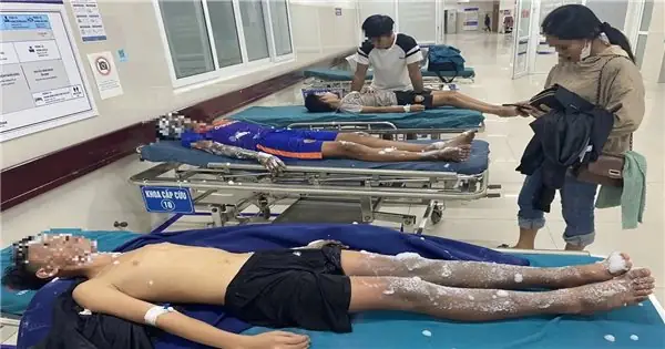Báo Động Tình Trạng Học Cách Tự Chế Pháo Nổ Trên Mạng - Hậu Quả ...