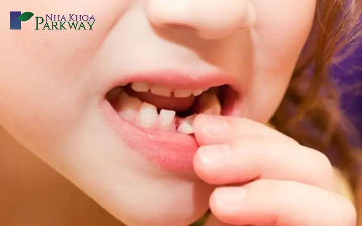 Nằm Mơ Gãy Răng Cửa Hàm Dưới