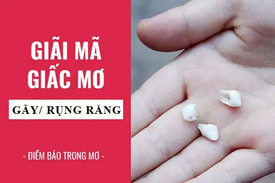 Nằm Mơ Thấy Hàm Răng Trắng Đẹp Là Điều May Mắn Và Mục Tiêu Gì Mà Nhiều Người Thường Tìm Kiếm Trên Google?