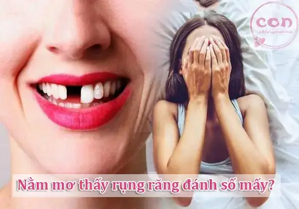 Mơ Thấy Mọc Răng Và Các Khía Cạnh Phong Thủy Mơ Thấy Mọc Răng Và Các Khía Cạnh Phong Thủy