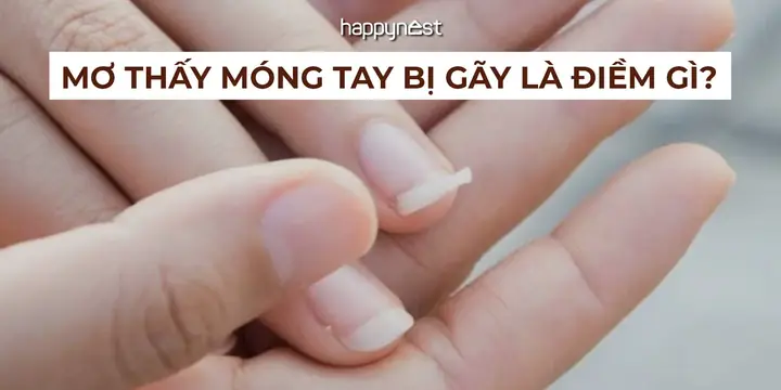 Mơ Thấy Móng Tay Bị Gãy Là Điềm Gì? May Mắn Hay Cảnh Báo Điều ...
