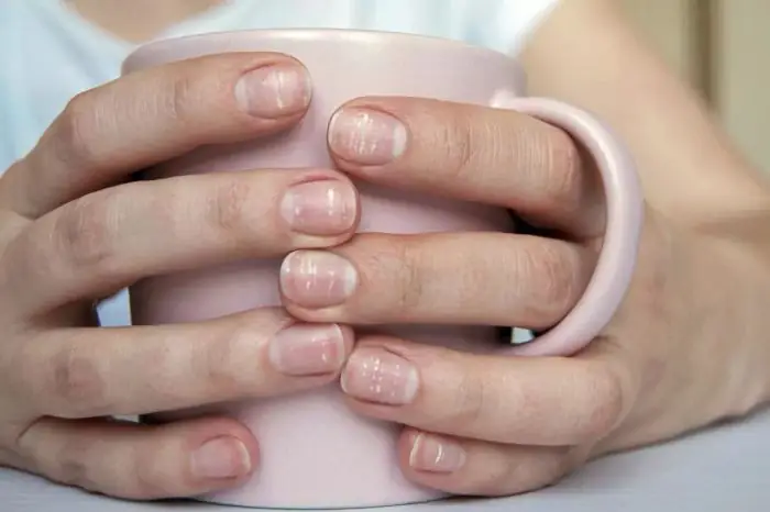 Mơ Móng Tay Rụng: Giải Mã Điềm Báo Chi Tiết