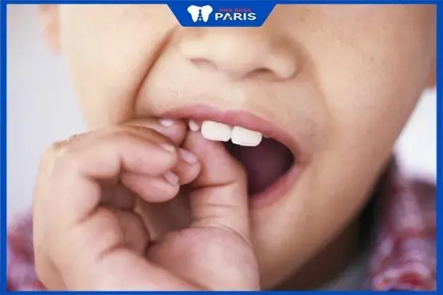 Nằm Mơ Thấy Tự Nhổ Răng Sâu