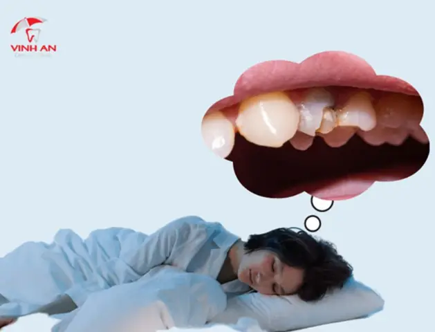 Nằm Mơ Thấy Mẻ Răng Đánh Con Gì ?