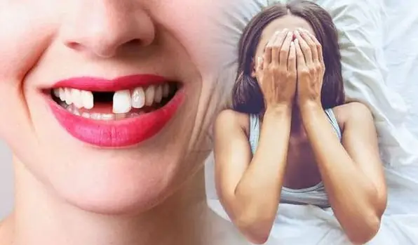Mơ Răng Rụng Khi Ăn Nhưng Không Đau & Không Máu