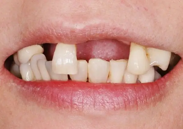 So Sánh Với Các Giấc Mơ “họ Hàng” Để Đối Chiếu