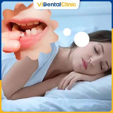 Mơ Thấy Rụng Răng Trong Các Nền Văn Hóa Và Tín Ngưỡng