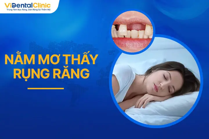 Nguyên Nhân Nằm Mơ Thấy Rụng Răng