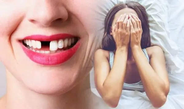 Nằm Mơ Thấy Rụng Răng Hàm Trên Chảy Máu Báo Hiệu Điều Gì? Giải Mã Chi Tiết