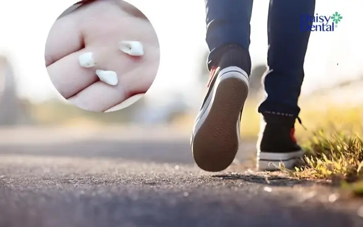 Nằm Mơ Thấy Rụng Răng Trên Đường